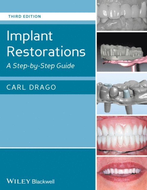 Carl Drago - Implant Restorations, E-bok