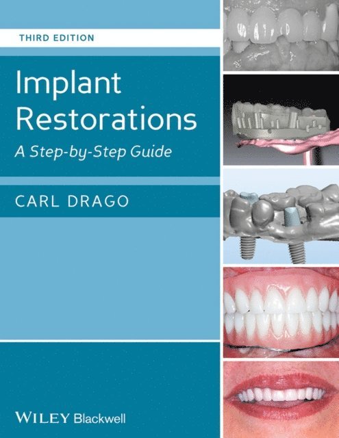 Carl Drago - Implant Restorations, E-bok