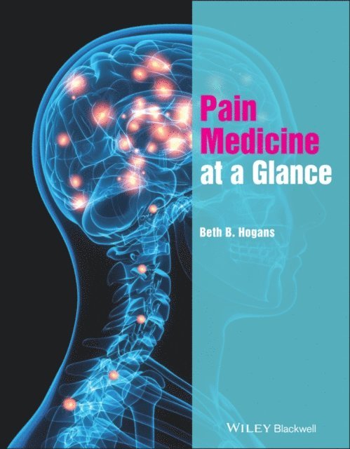Beth B. Hogans - Pain Medicine at a Glance, E-bok. Tillgänglighet: Lägg i varukorg