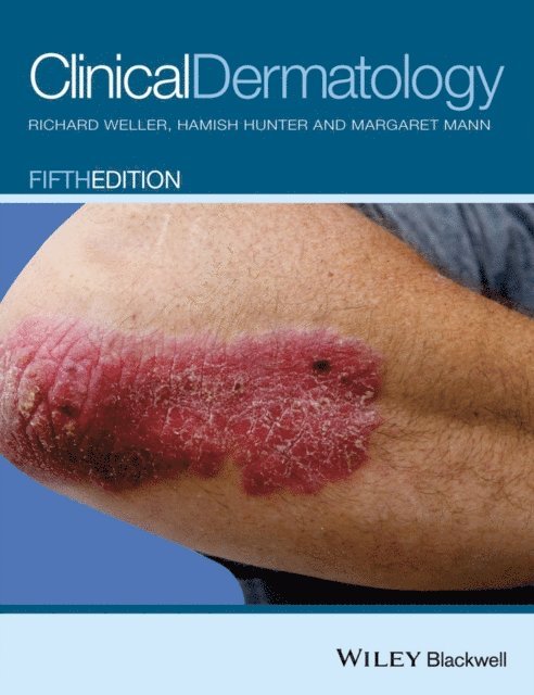 Margaret W. Mann, Hamish J. A. Hunter, Richard B. Weller - Clinical Dermatology, E-bok. Tillgänglighet: Lägg i varukorg