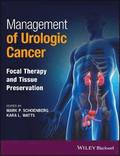 Management of Urologic Cancer