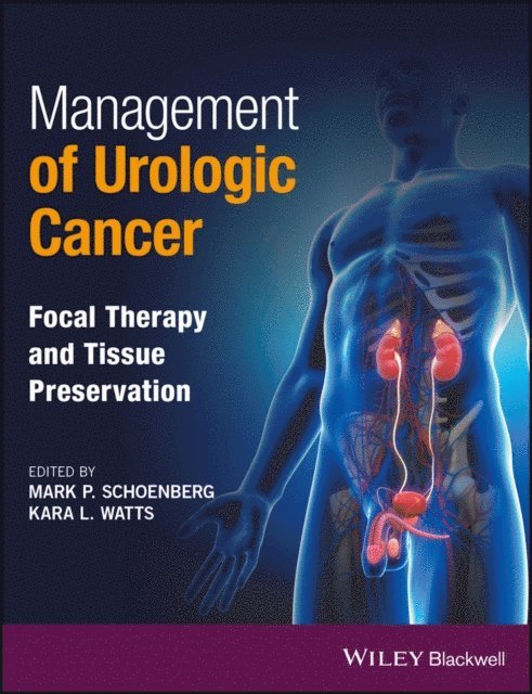 Kara L. Watts, Mark P. Schoenberg - Management of Urologic Cancer, E-bok