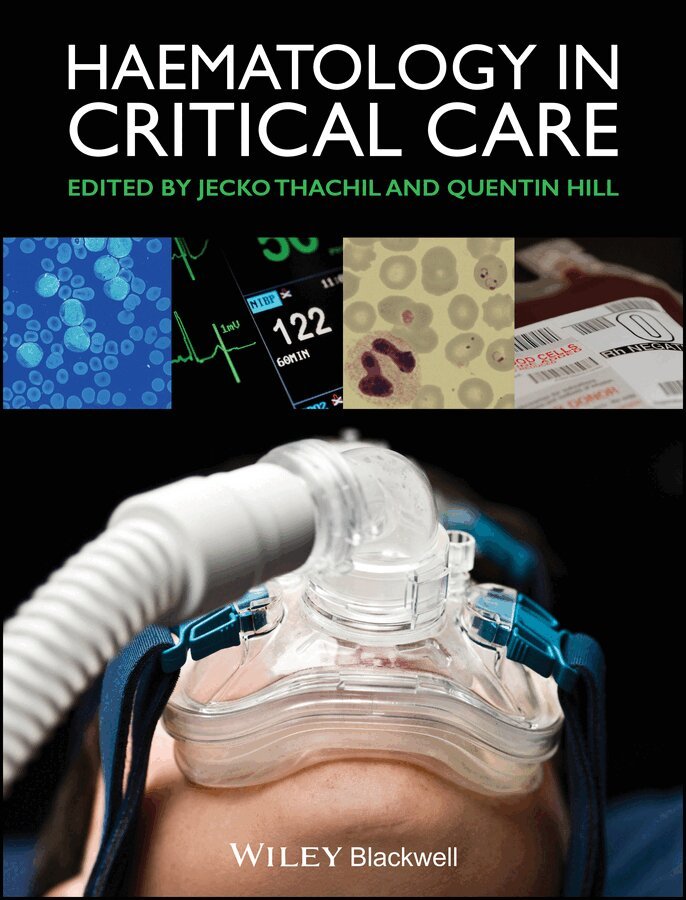 Jecko Thachil, Quentin Hill - Haematology in Critical Care – A Practical Handbook. Tillgänglighet: Tillfälligt slut