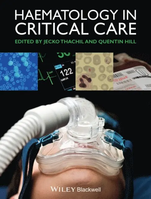 Quentin Hill, Jecko Thachil - Haematology in Critical Care, E-bok. Tillgänglighet: Lägg i varukorg
