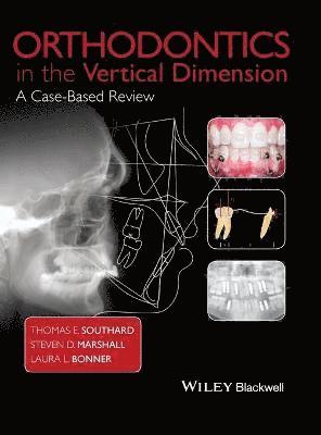 Thomas E. Southard, Steven D. Marshall, Laura L. Bonner - Orthodontics in the Vertical Dimension, Inbunden