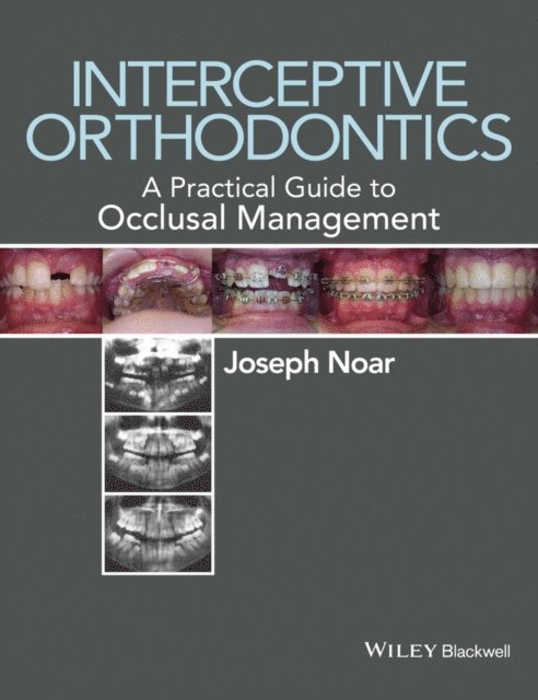 Joseph Noar - Interceptive Orthodontics, E-bok. Tillgänglighet: Lägg i varukorg