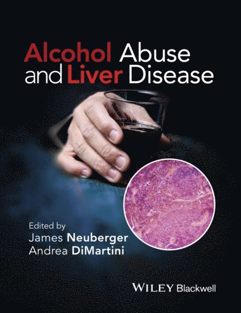 Andrea DiMartini, James Neuberger - Alcohol Abuse and Liver Disease, E-bok