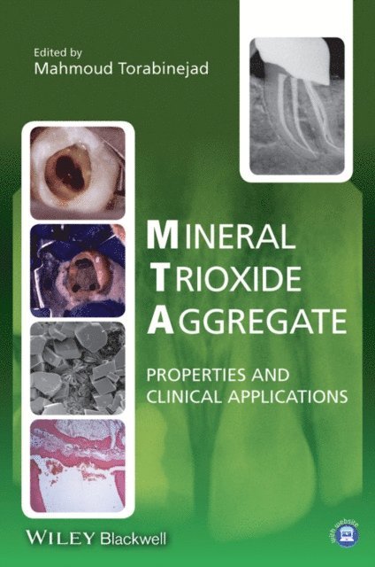 Mahmoud Torabinejad - Mineral Trioxide Aggregate, E-bok