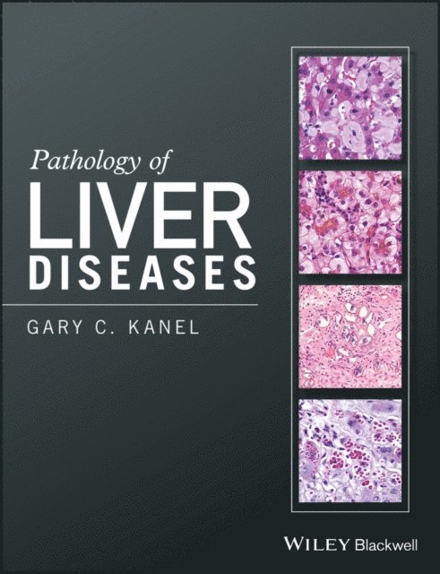 Gary C. Kanel - Pathology of Liver Diseases, E-bok