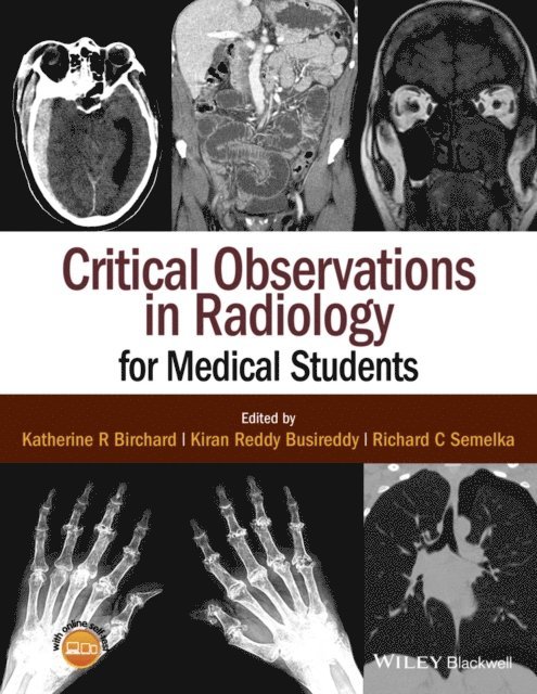 Richard C. Semelka, Kiran Reddy Busireddy, Katherine R. Birchard - Critical Observations in Radiology for Medical Students, E-bok