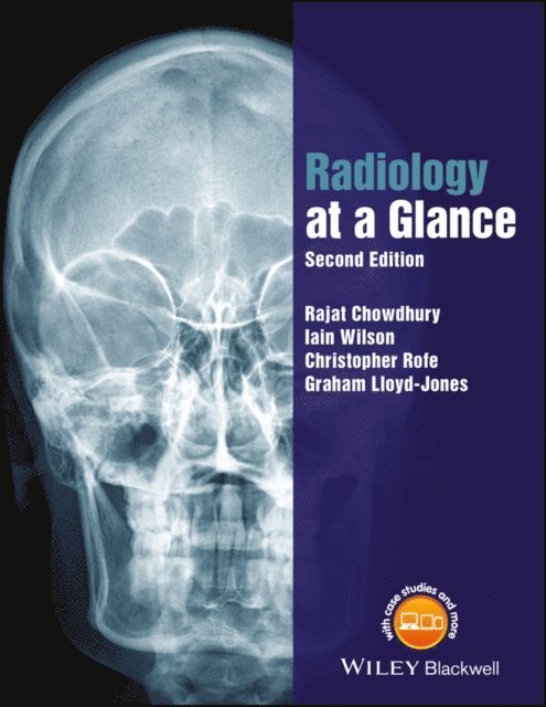 Graham Lloyd-Jones, Christopher Rofe, Iain Wilson, Rajat Chowdhury - Radiology at a Glance, E-bok