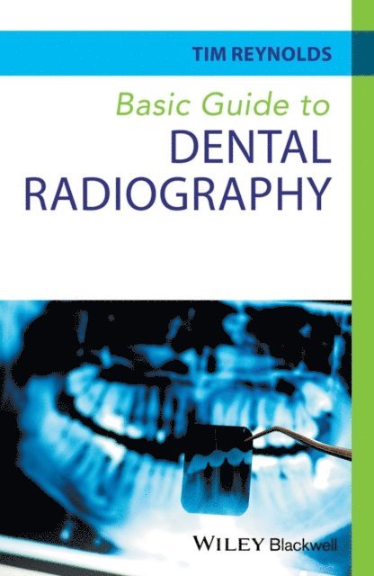 Tim Reynolds - Basic Guide to Dental Radiography, E-bok