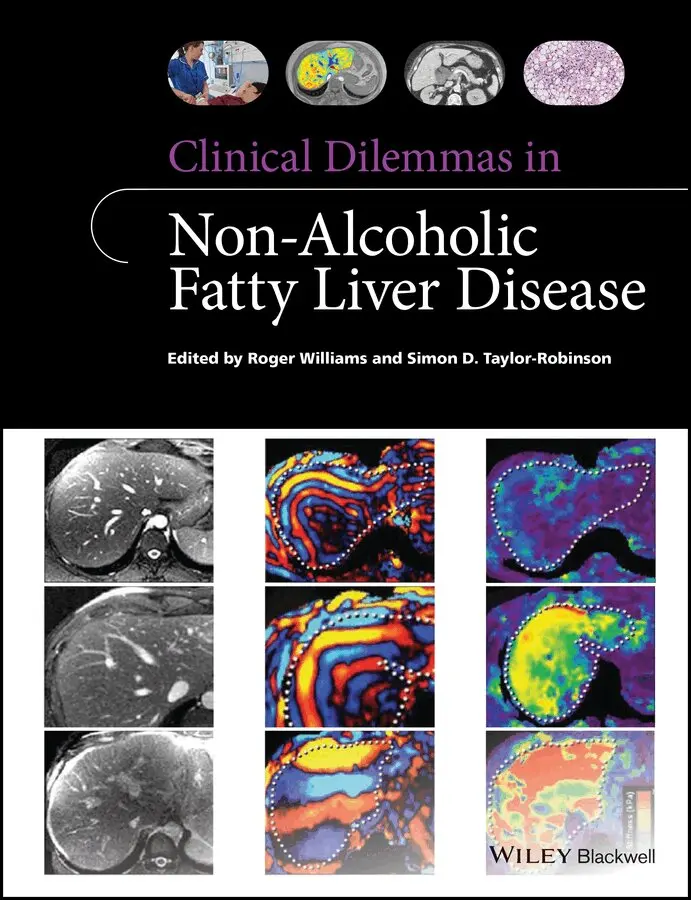 Roger Williams, Simon D. Taylor-Robinson - Clinical Dilemmas in Non–Alcoholic Fatty Liver Disease. Tillgänglighet: Tillfälligt slut