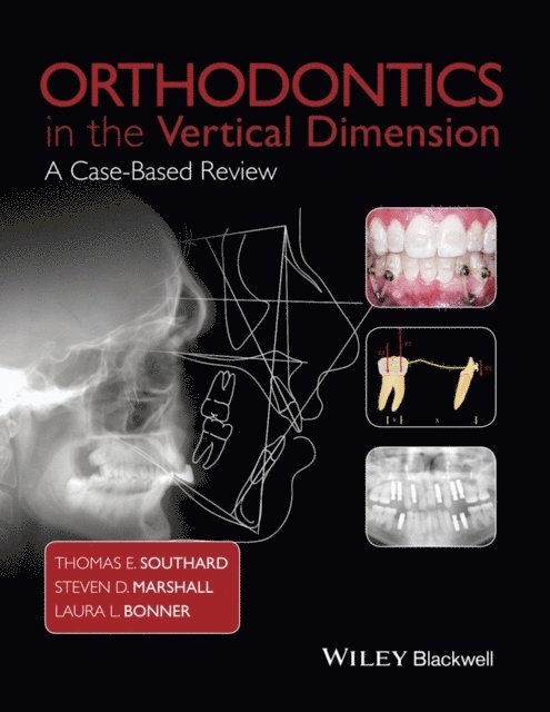 Laura L. Bonner, Steven D. Marshall, Thomas E. Southard - Orthodontics in the Vertical Dimension, E-bok