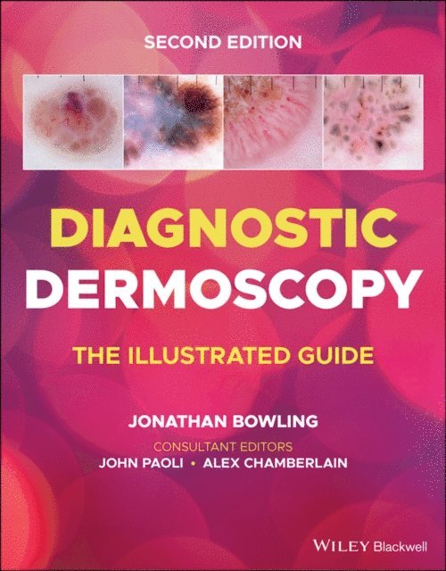 Jonathan Bowling - Diagnostic Dermoscopy, E-bok