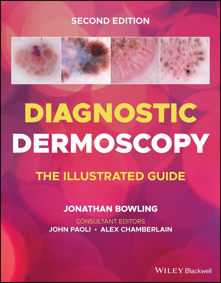 Jonathan Bowling - Diagnostic Dermoscopy – The Illustrated Guide, 2e. Tillgänglighet: Tillfälligt slut
