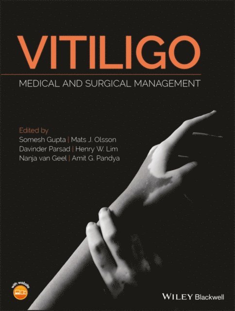Amit G. Pandya, Nanja van Geel, Henry W. Lim, Dr. Davinder Parsad, Dr. Mats J. Olsson, Somesh Gupta - Vitiligo, E-bok