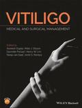 Vitiligo