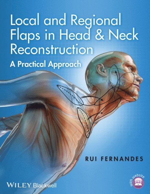 Rui Fernandes - Local and Regional Flaps in Head and Neck Reconstruction, E-bok