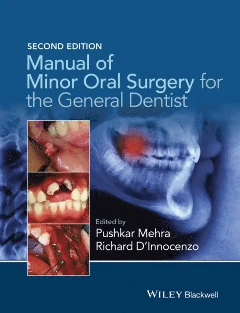 Richard D'Innocenzo, Pushkar Mehra - Manual of Minor Oral Surgery for the General Dentist, E-bok. Tillgänglighet: Lägg i varukorg