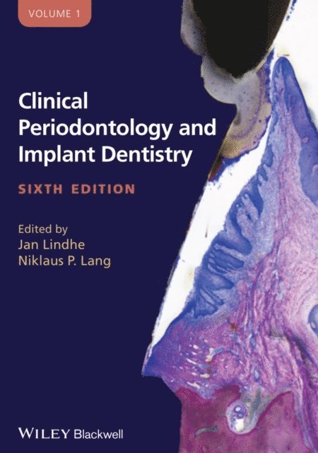 Jan Lindhe, Niklaus P. Lang - Clinical Periodontology and Implant Dentistry, 2 Volume Set, E-bok