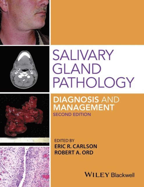 Robert A. Ord, Eric R. Carlson - Salivary Gland Pathology, E-bok
