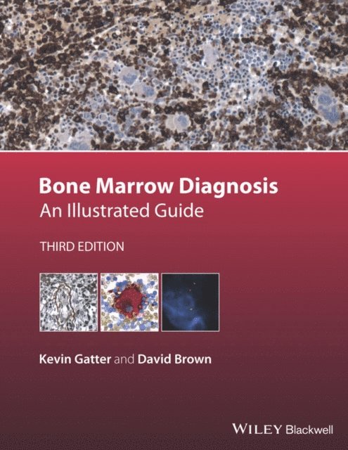 David Brown, Kevin Gatter - Bone Marrow Diagnosis, E-bok