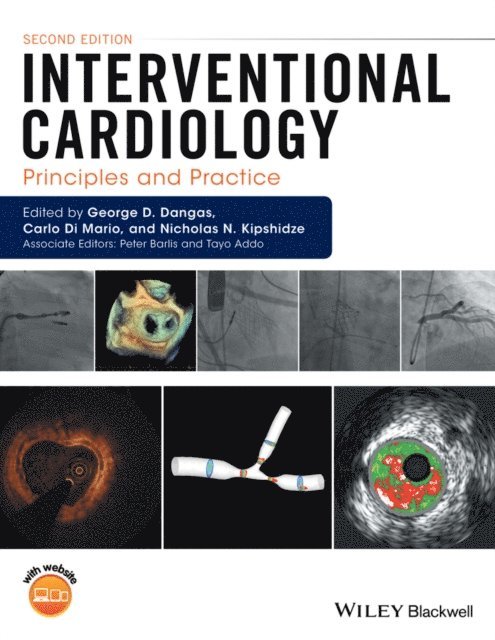 Nicholas N. Kipshidze, Carlo Di Mario, George D. Dangas - Interventional Cardiology, E-bok