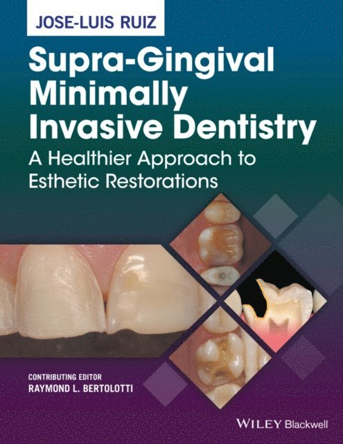Jose-Luis Ruiz - Supra-Gingival Minimally Invasive Dentistry, E-bok