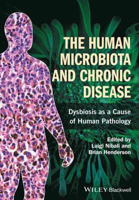 Brian Henderson, Luigi Nibali - Human Microbiota and Chronic Disease, E-bok
