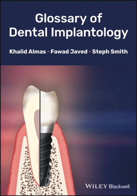 Steph Smith, Fawad Javed, Khalid Almas - Glossary of Dental Implantology, E-bok