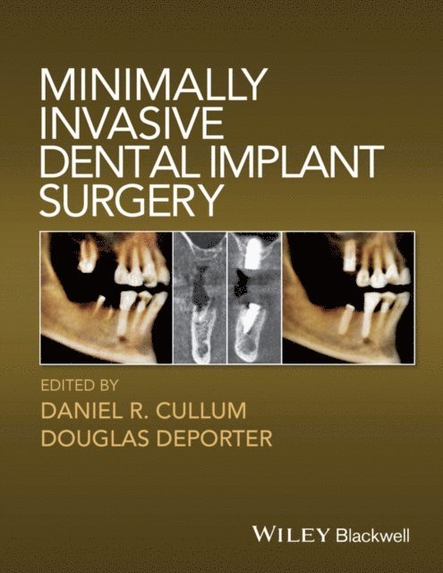 Douglas Deporter, Daniel R. Cullum - Minimally Invasive Dental Implant Surgery, E-bok