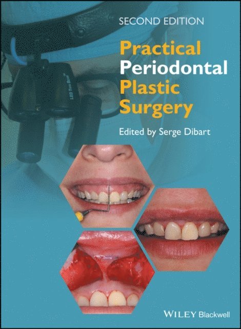 Serge Dibart - Practical Periodontal Plastic Surgery, E-bok