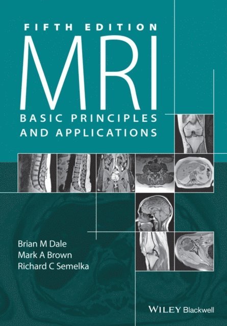 Richard C. Semelka, Mark A. Brown, Brian M. Dale - MRI, E-bok