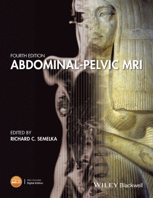 Richard C. Semelka - Abdominal-Pelvic MRI, E-bok