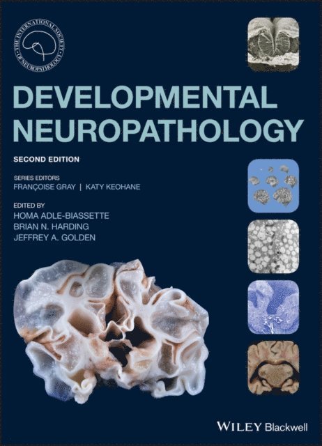 Jeffrey A. Golden, Brian N. Harding, Homa Adle-Biassette - Developmental Neuropathology, E-bok