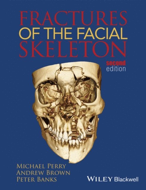 Peter Banks, Andrew Brown, Michael Perry - Fractures of the Facial Skeleton, E-bok