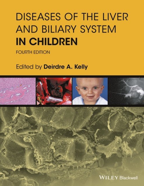 Deirdre A. Kelly - Diseases of the Liver and Biliary System in Children, E-bok