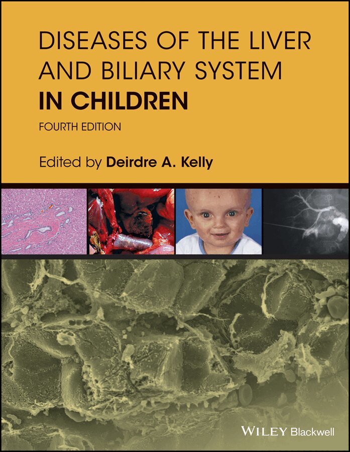Deirdre A. Kelly - Diseases of the Liver & Biliary System in Children 4e. Tillgänglighet: Tillfälligt slut