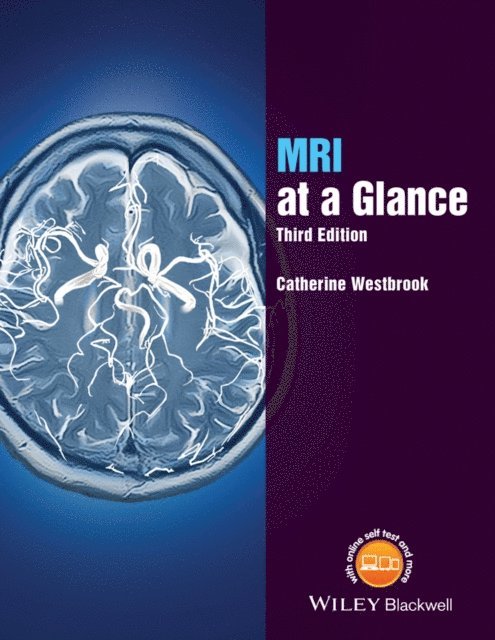 Catherine Westbrook - MRI at a Glance, E-bok