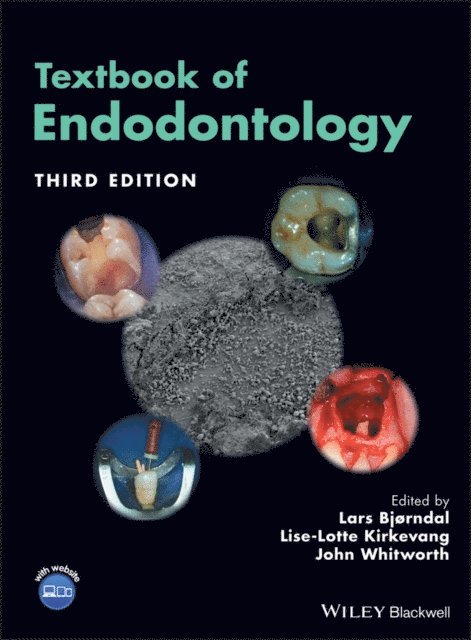 John Whitworth, Lise-Lotte Kirkevang, Lars Bj rndal - Textbook of Endodontology, E-bok