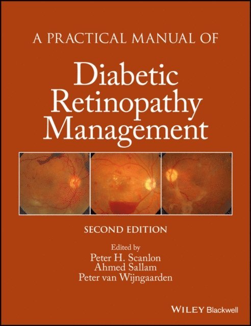 Peter van Wijngaarden, Ahmed Sallam, Peter H. Scanlon - Practical Manual of Diabetic Retinopathy Management, E-bok