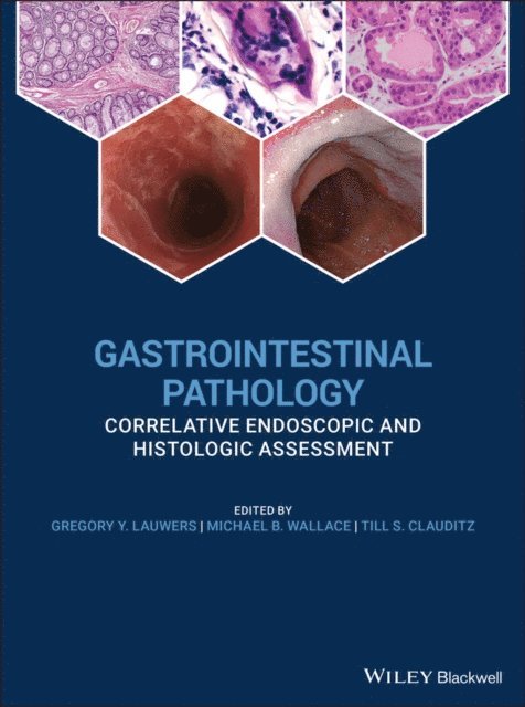 Michael B. Wallace, Gregory Y. Lauwers - Gastrointestinal Pathology, E-bok