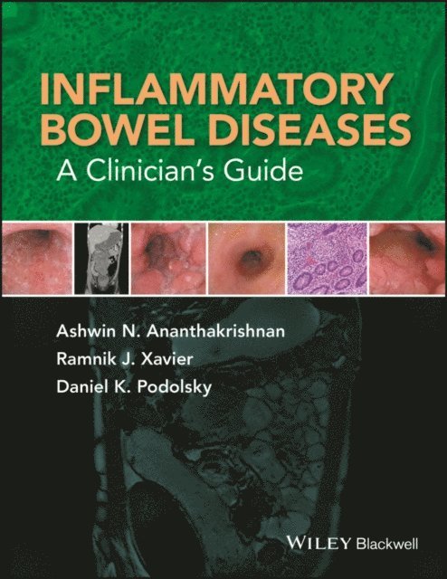 Daniel K. Podolsky, Ramnik J. Xavier, Ashwin N. Ananthakrishnan - Inflammatory Bowel Diseases, E-bok. Tillgänglighet: Lägg i varukorg