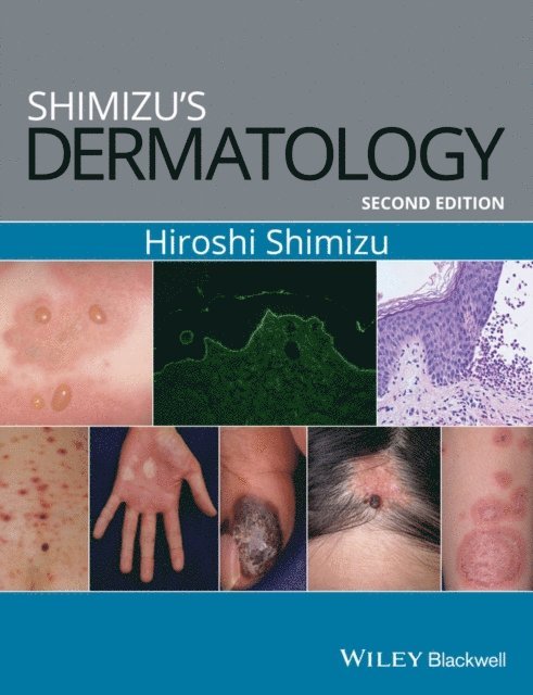 Hiroshi Shimizu - Shimizu's Dermatology, E-bok