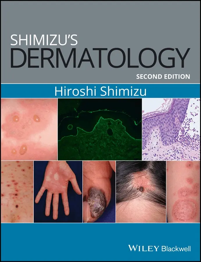 H Shimizu - Shimizu′s Dermatology 2e. Tillgänglighet: Tillfälligt slut