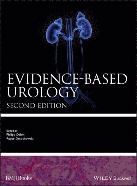 Roger Dmochowski, Philipp Dahm - Evidence-based Urology, E-bok