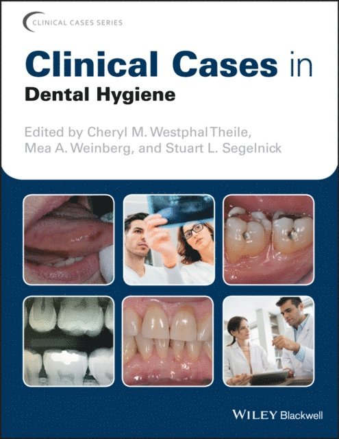 Stuart L. Segelnick, Mea A. Weinberg, Cheryl M. Westphal Theile - Clinical Cases in Dental Hygiene, E-bok