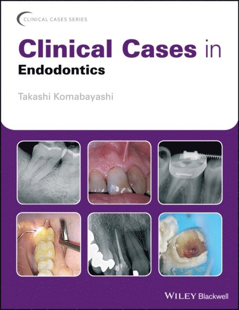 Takashi Komabayashi - Clinical Cases in Endodontics, E-bok