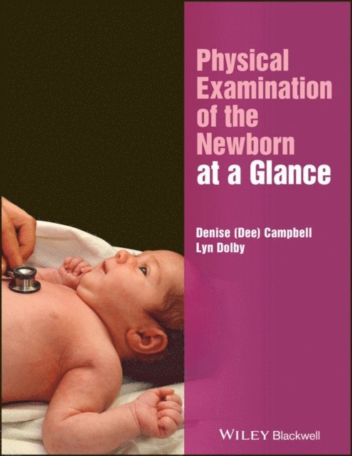 Lyn Dolby, Denise Campbell - Physical Examination of the Newborn at a Glance, E-bok